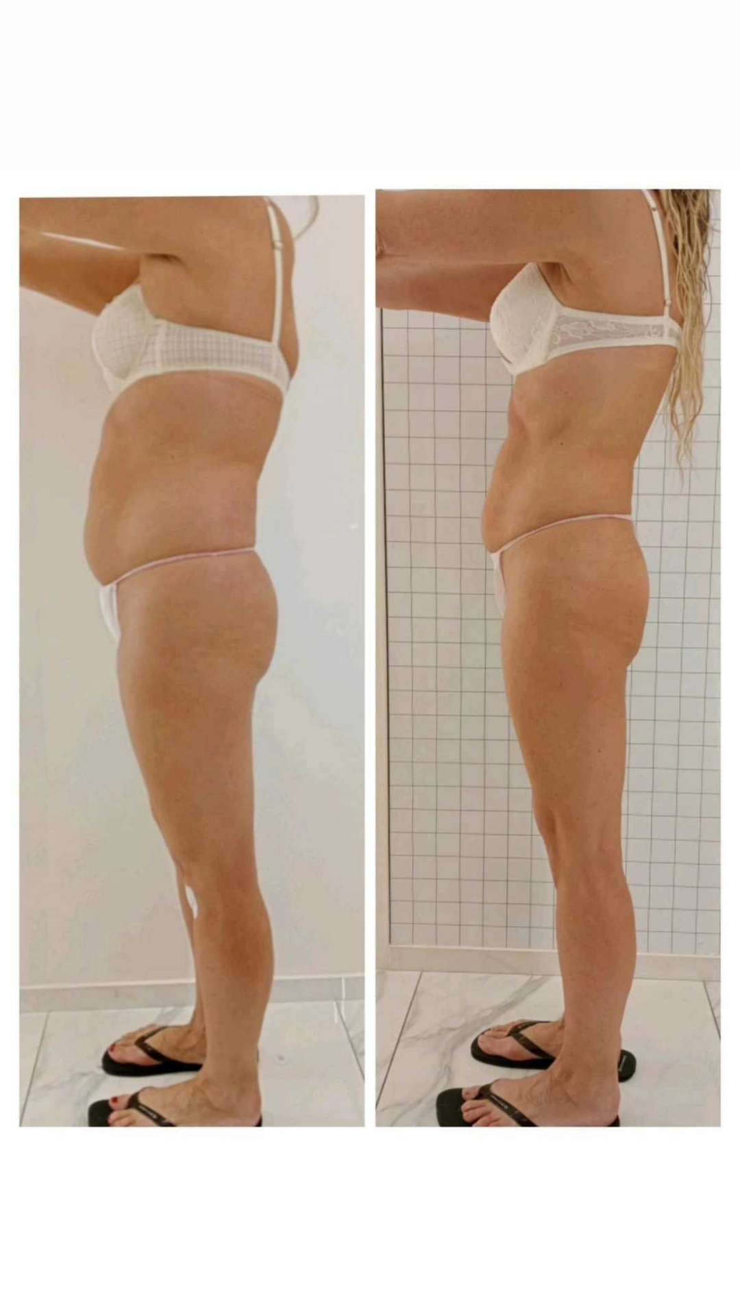 Risultato Body Shape Modeling: confronto silhouette prima e dopo il trattamento